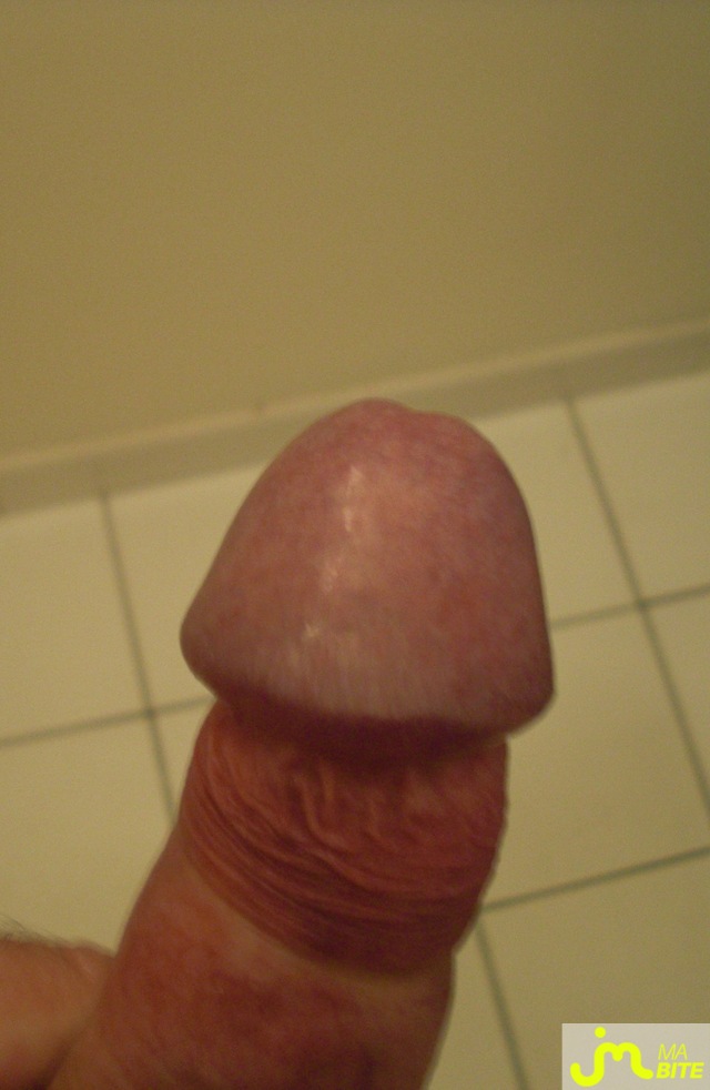 bites de bebe