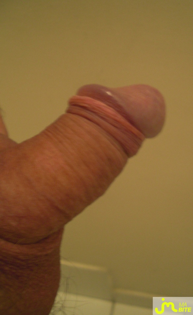 bites de bebe