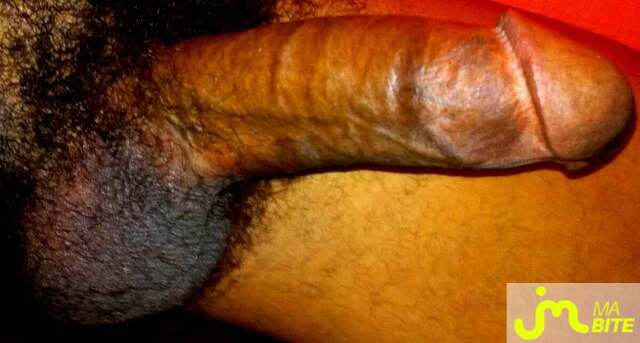 bites de tyrondbbw@yahoo.com