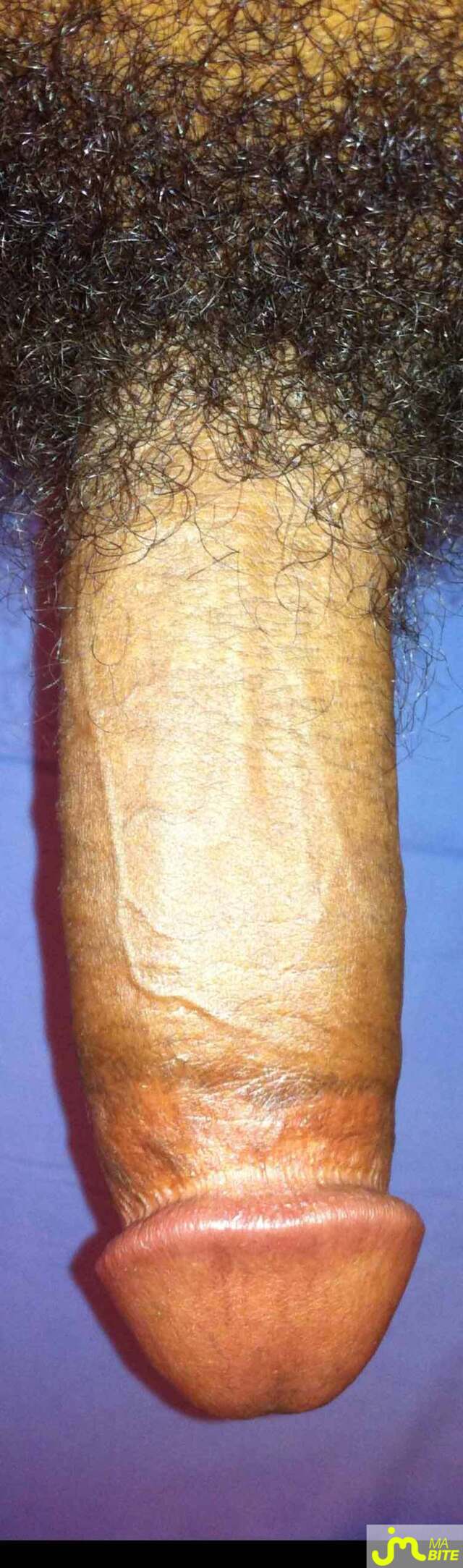 bites de tyrondbbw@yahoo.com
