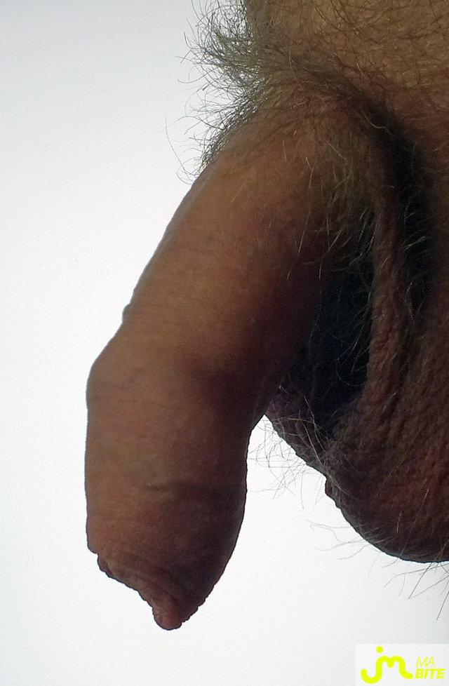 bites de gaym40