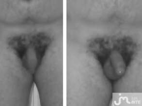 Photos de bites : 1er