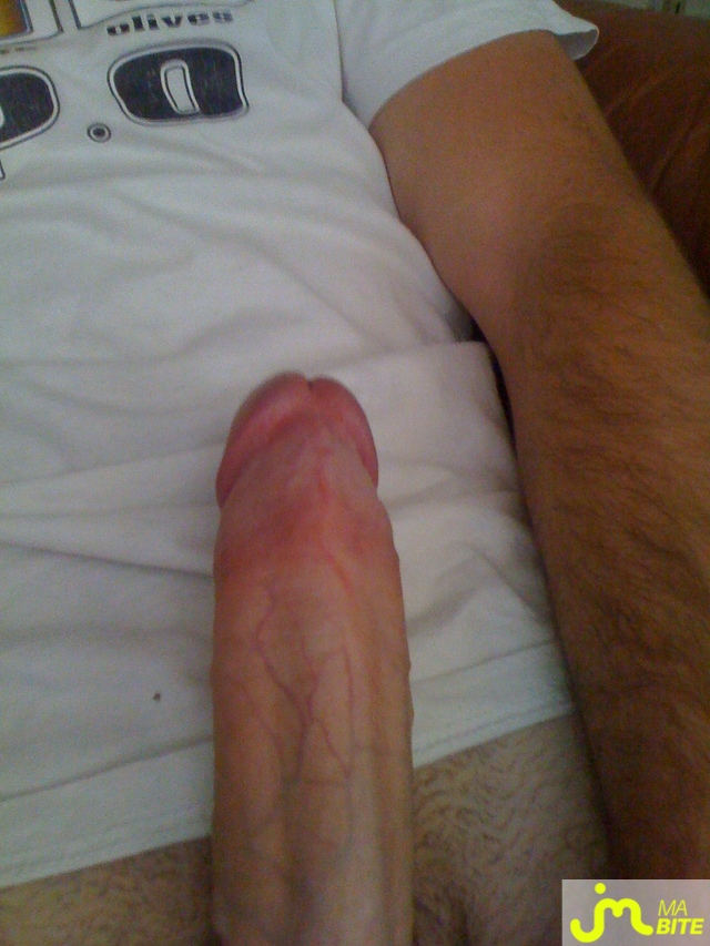 bites de matt27118723