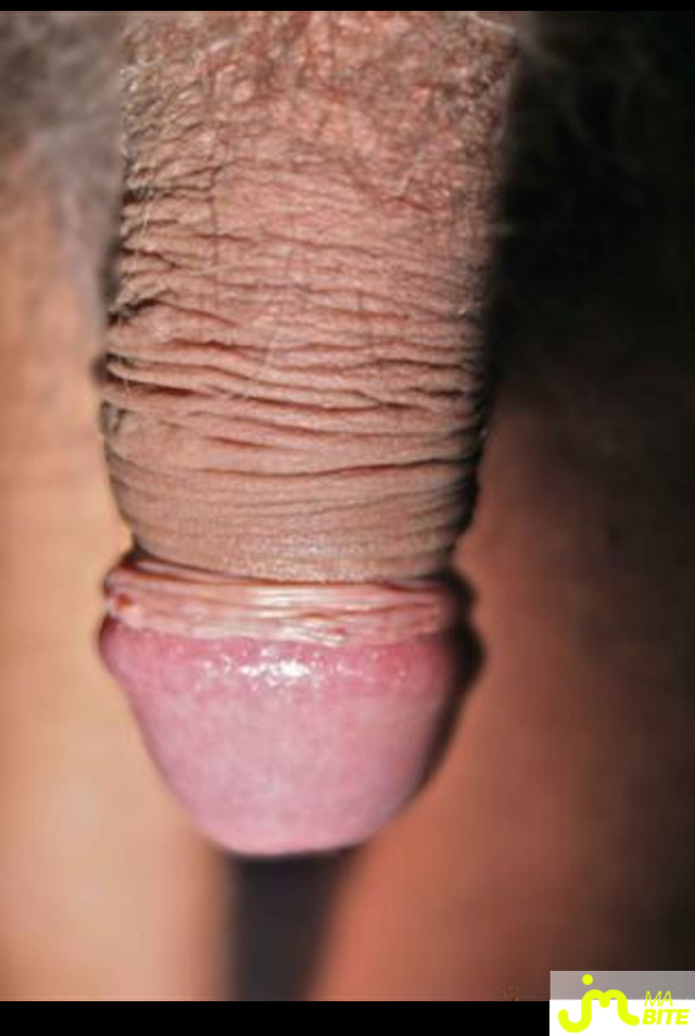 bites de Cardine