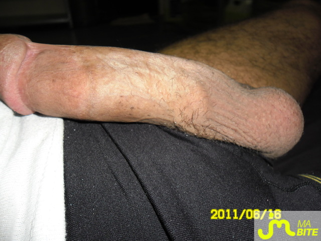 bites de fabio7500