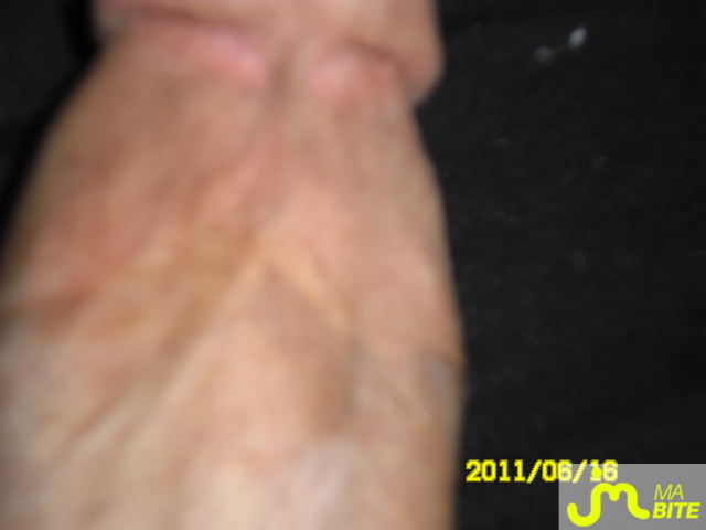 bites de fabio7500