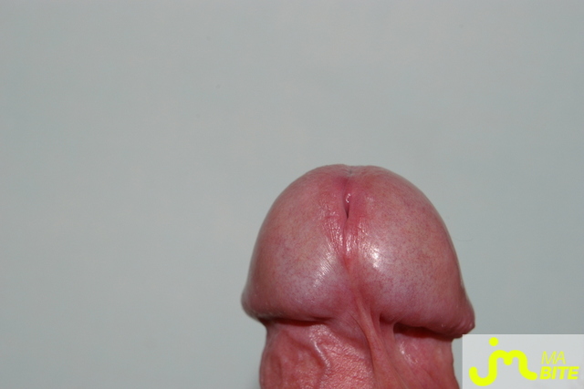 bites de 1kikoo