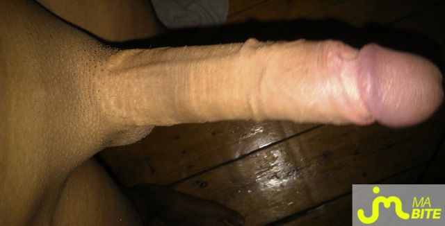 bites de jeunemecdu69