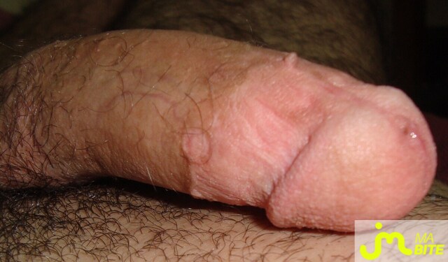 bites de charliemotley