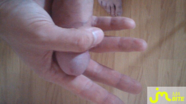 bites de ouch
