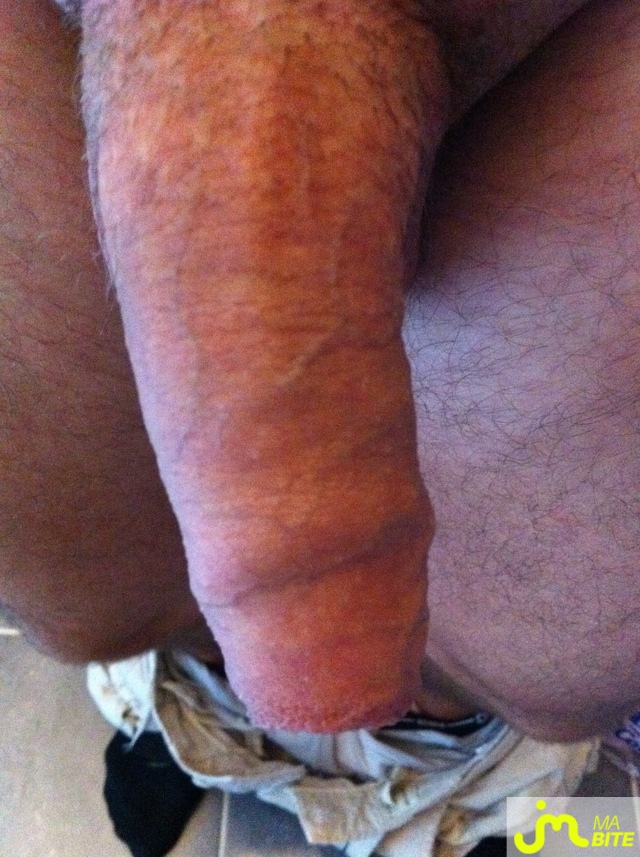 bites de ronaldo1