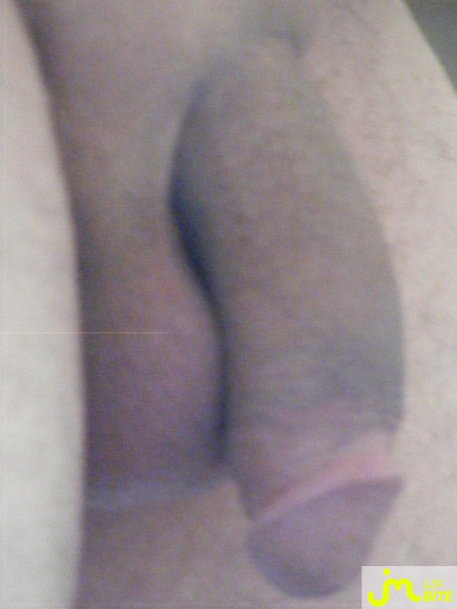 bites de lepif80