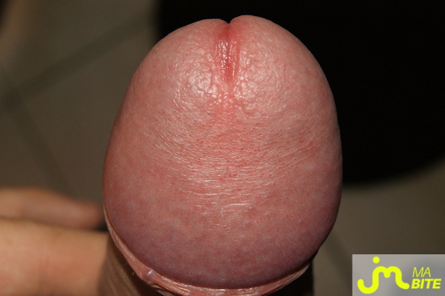 bites de keke40