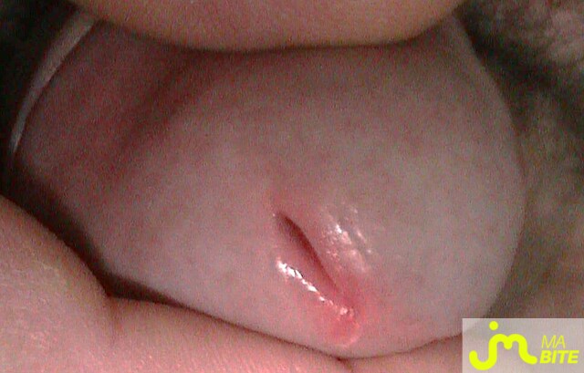 bites de cidouadeux