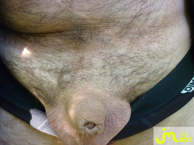 bites de clopclop