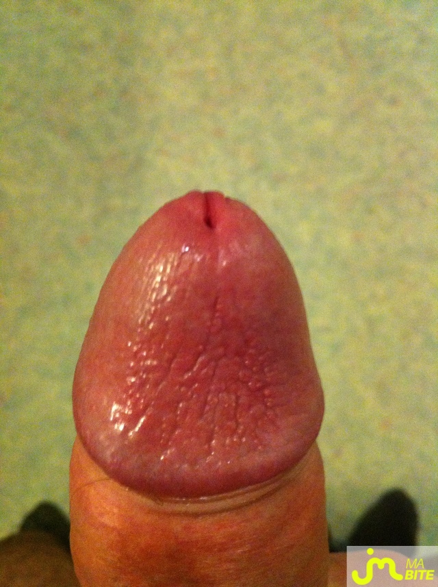 bites de podg2