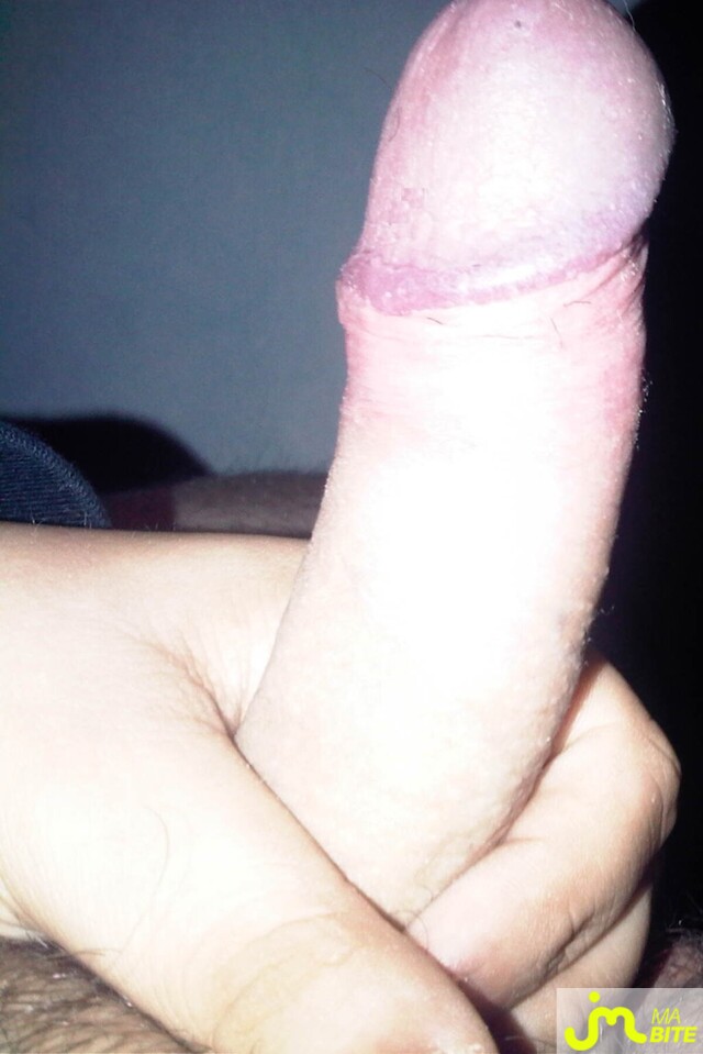 bites de Choupinou35