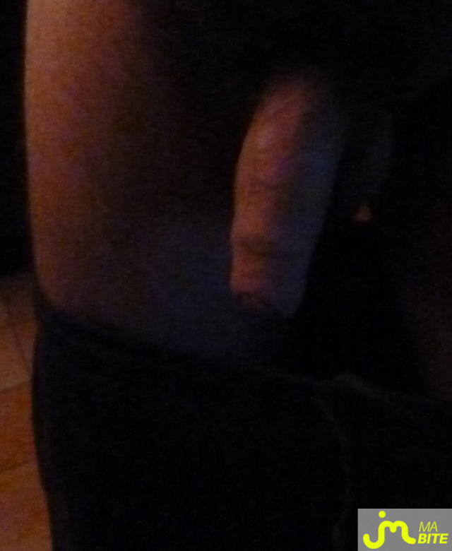 bites de AVD