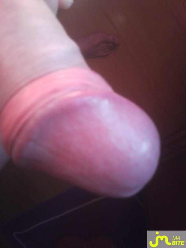 bites de bobi