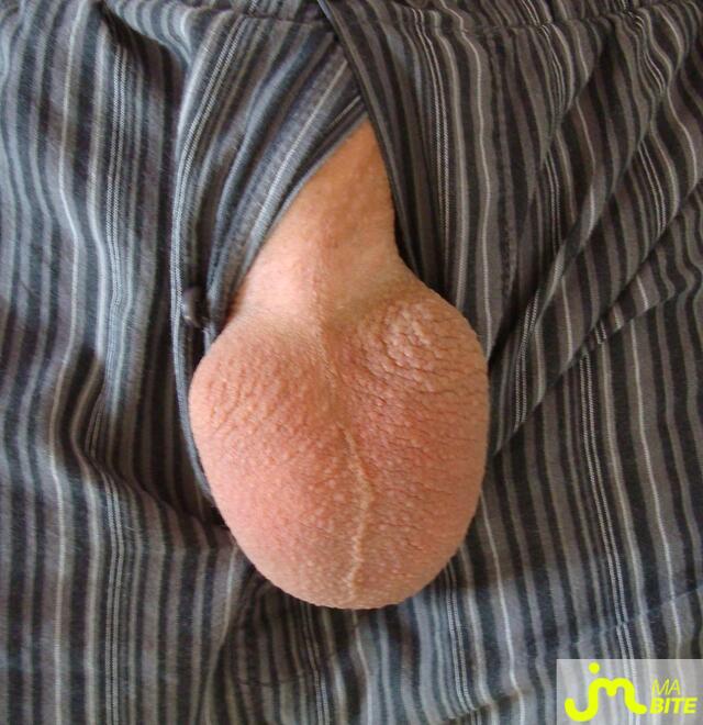 bites de Dunpeal