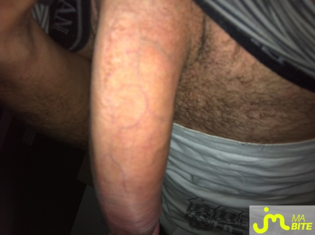 bites de bm83