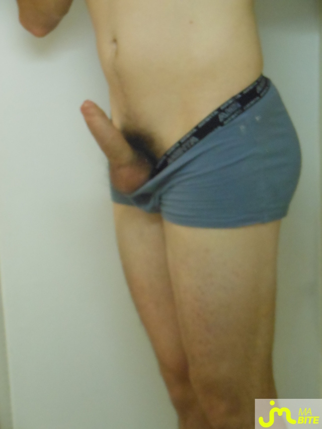 bites de suckmick