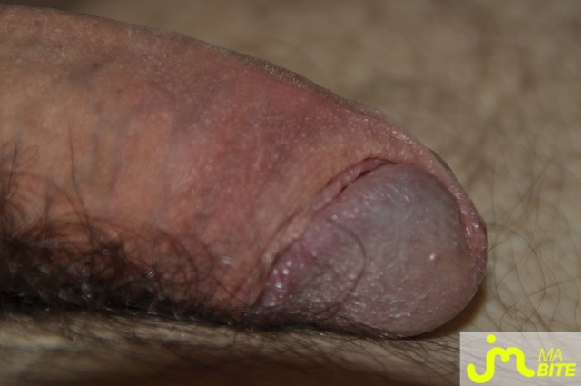 bites de JK75