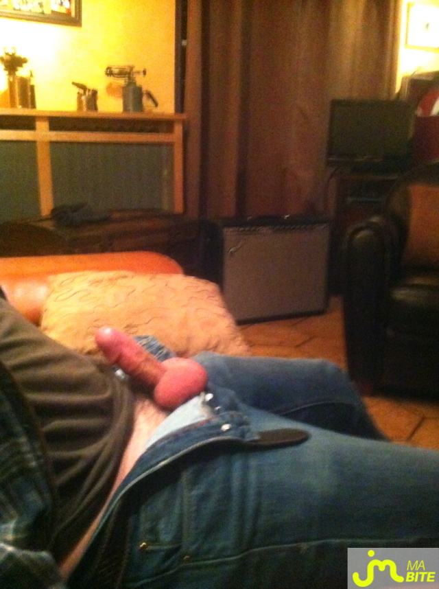 bites de penis75