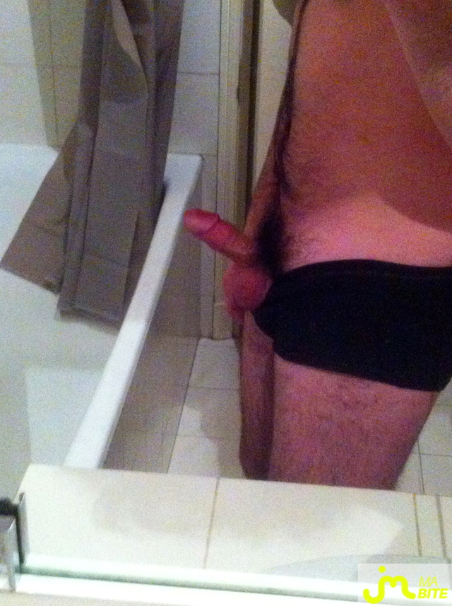 bites de penis75