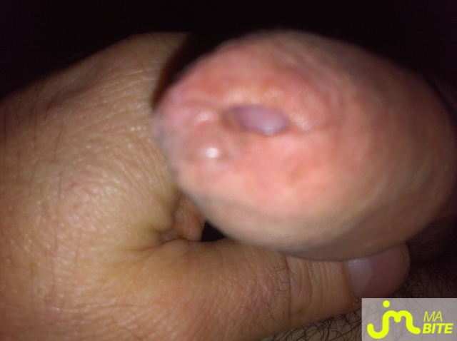 bites de tileo