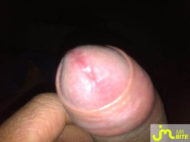 bites de tileo