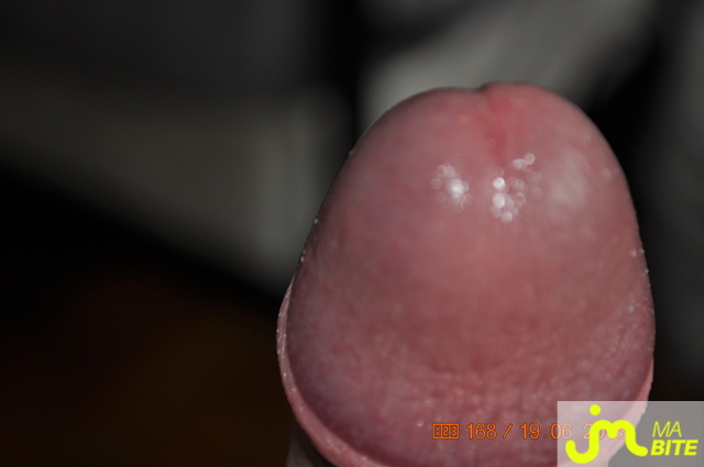 bites de jack45