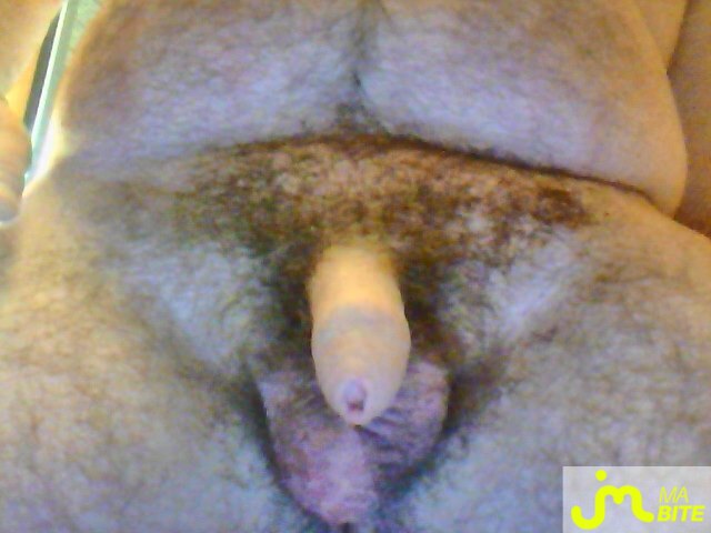 bites de hairydickmrs