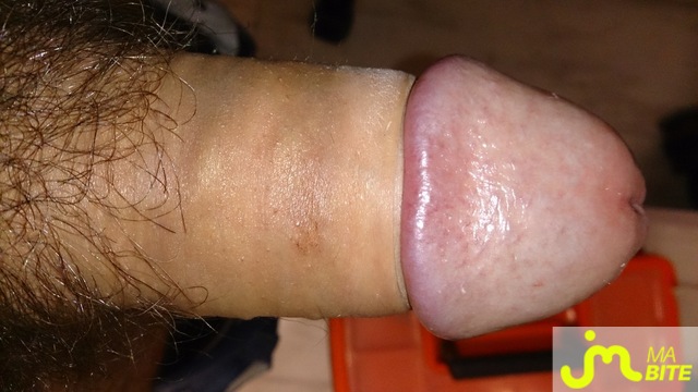 bites de sgg