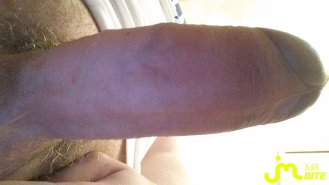 bites de BitePosey