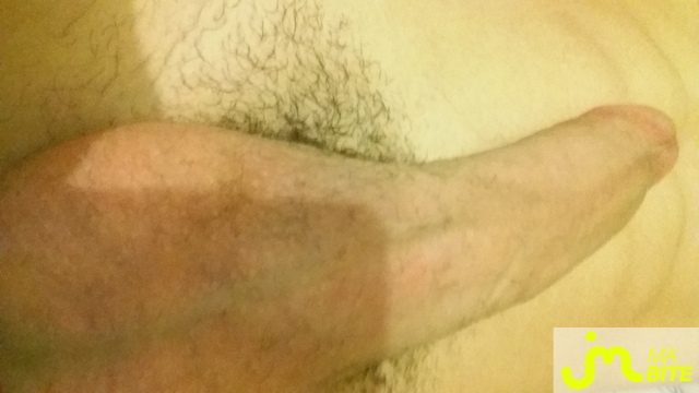 bites de raphhh