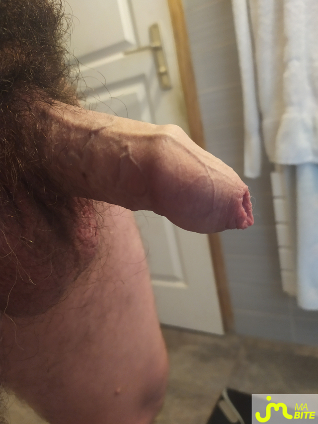 bites de Kp25