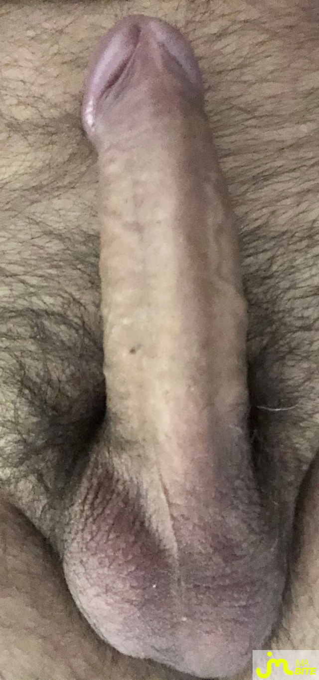 bites de Membre31