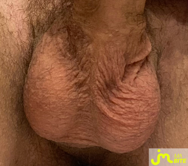 bites de Fred78!