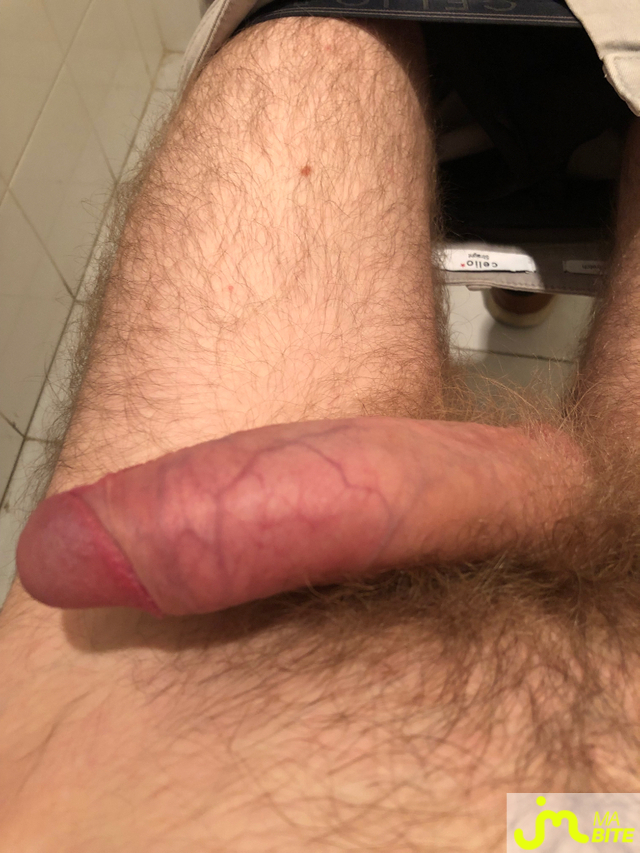 bites de Petersexe