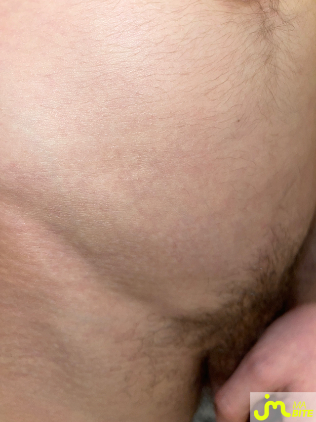 bites de Jhom76