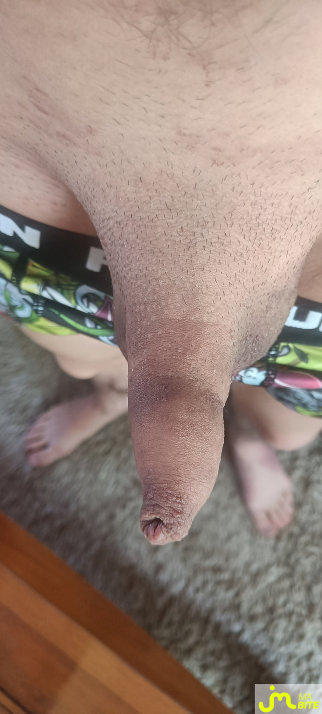 bites de antoinechai49