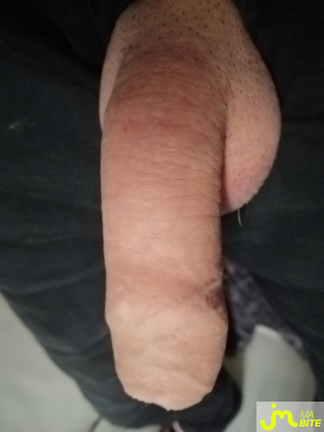 bites de Cocklover83