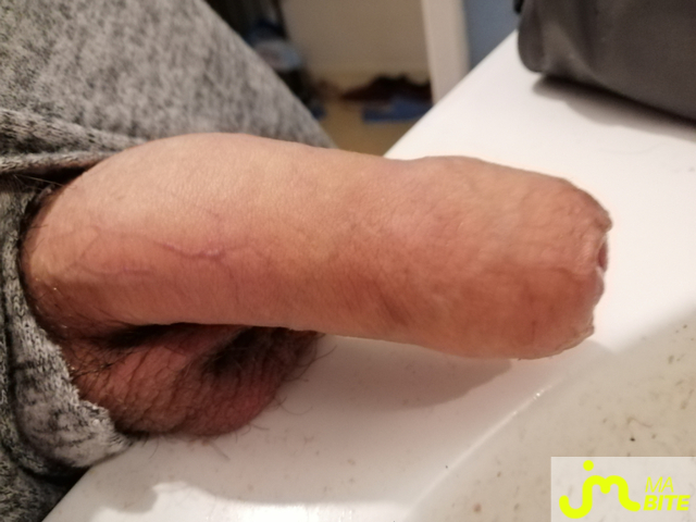 bites de Cocklover83