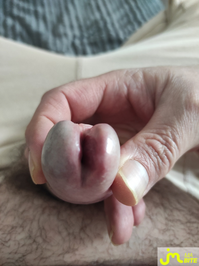 bites de testicles83