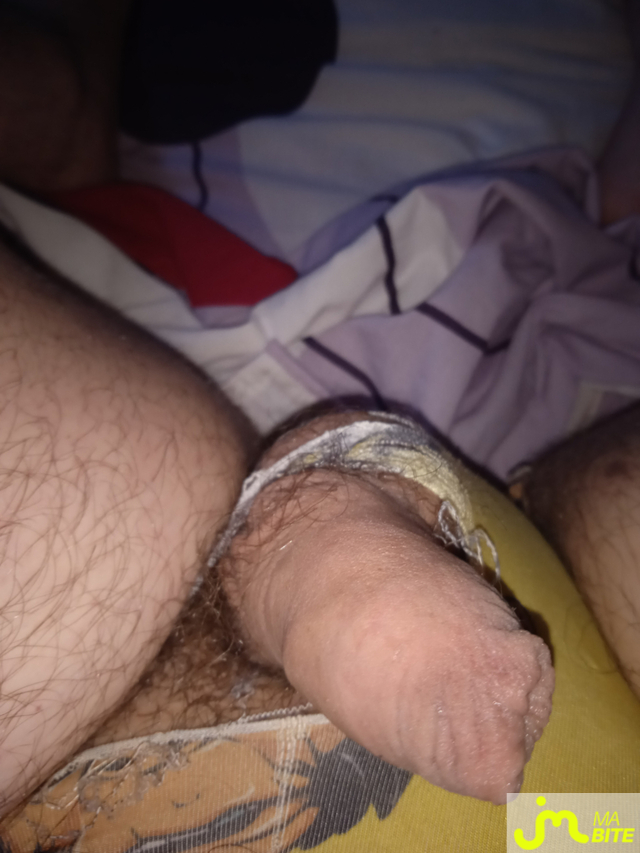 bites de Dick_tiny_76