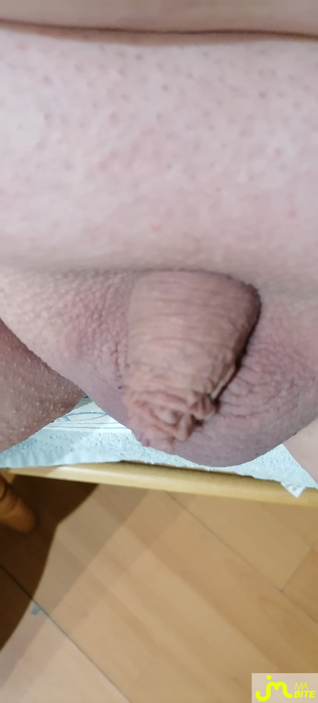 bites de Petitsexe67