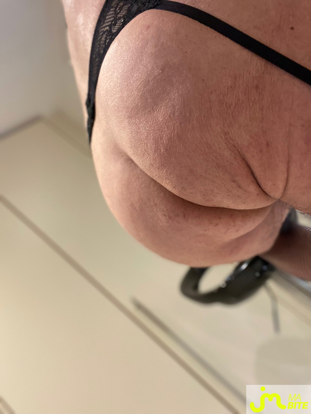 bites de Menelas