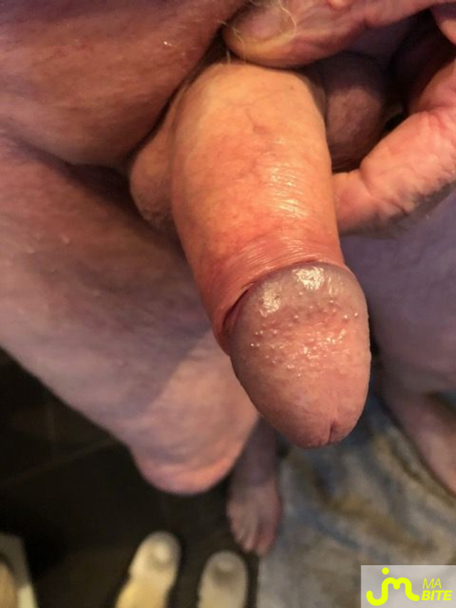 bites de luc 35