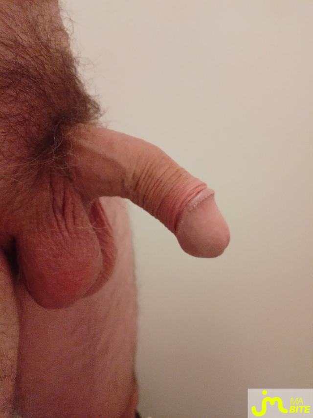 bites de Gvcg 